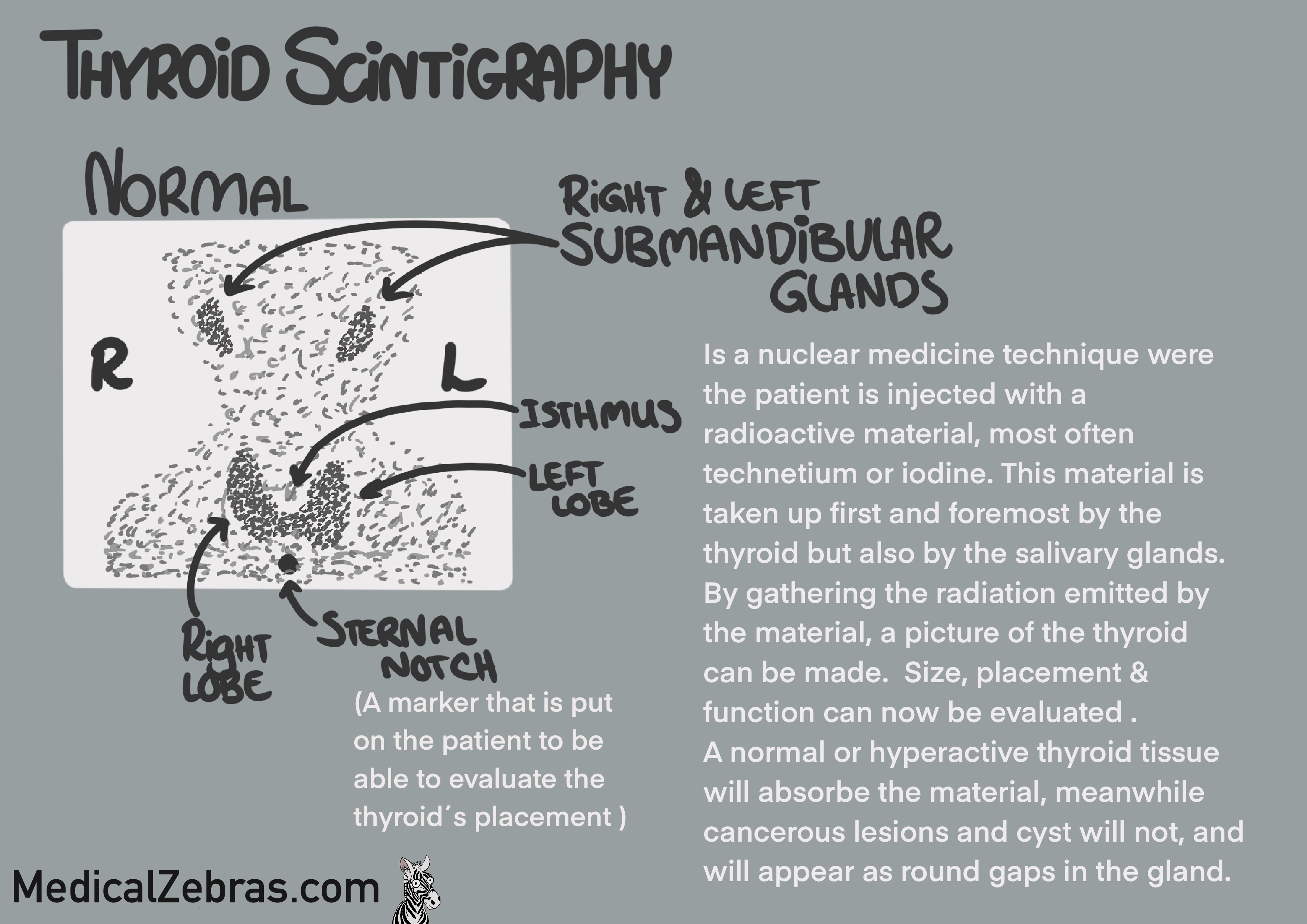 Thyroid anatomy