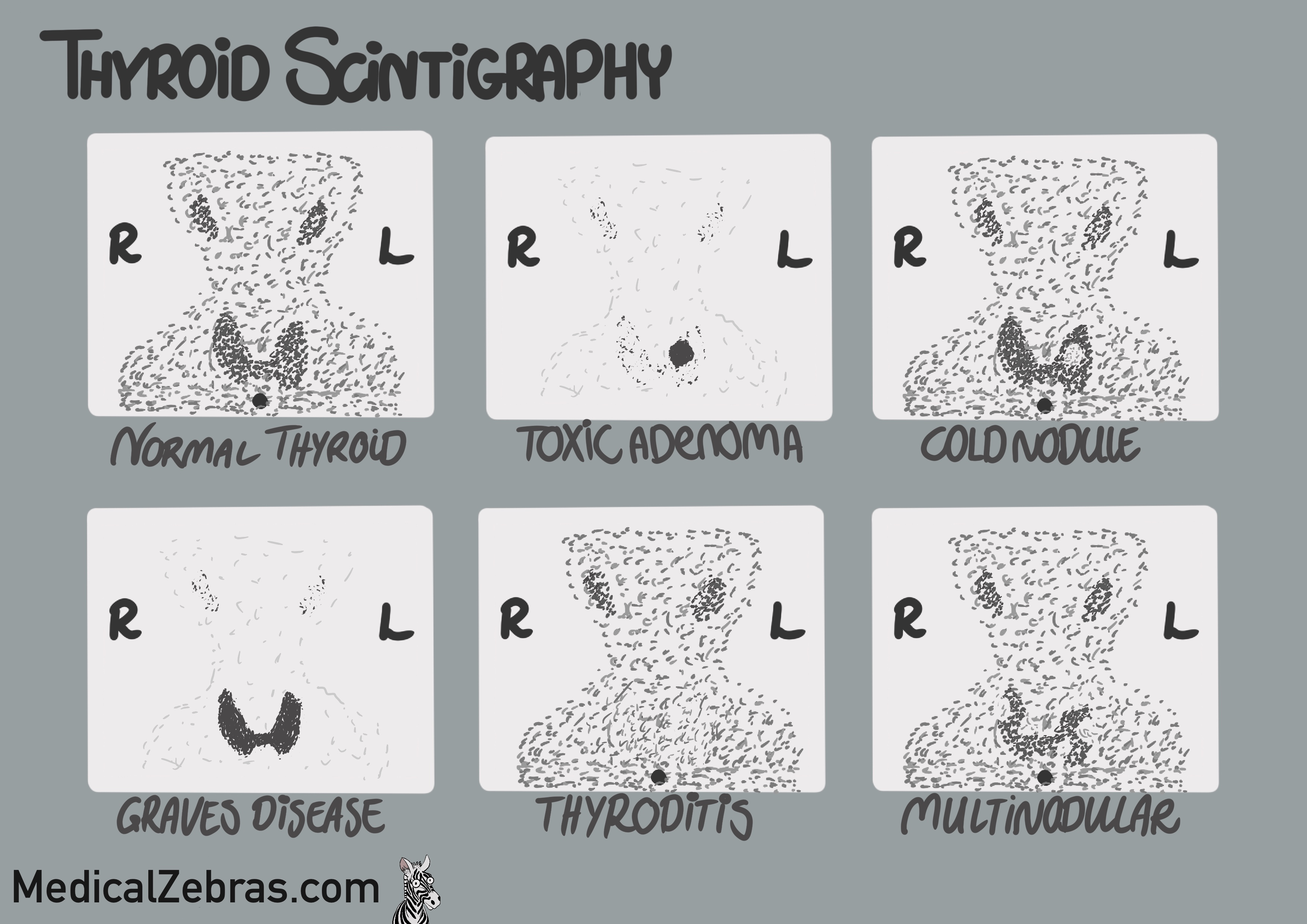 Thyroid anatomy